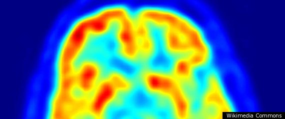 r-BRAIN-large570.jpg