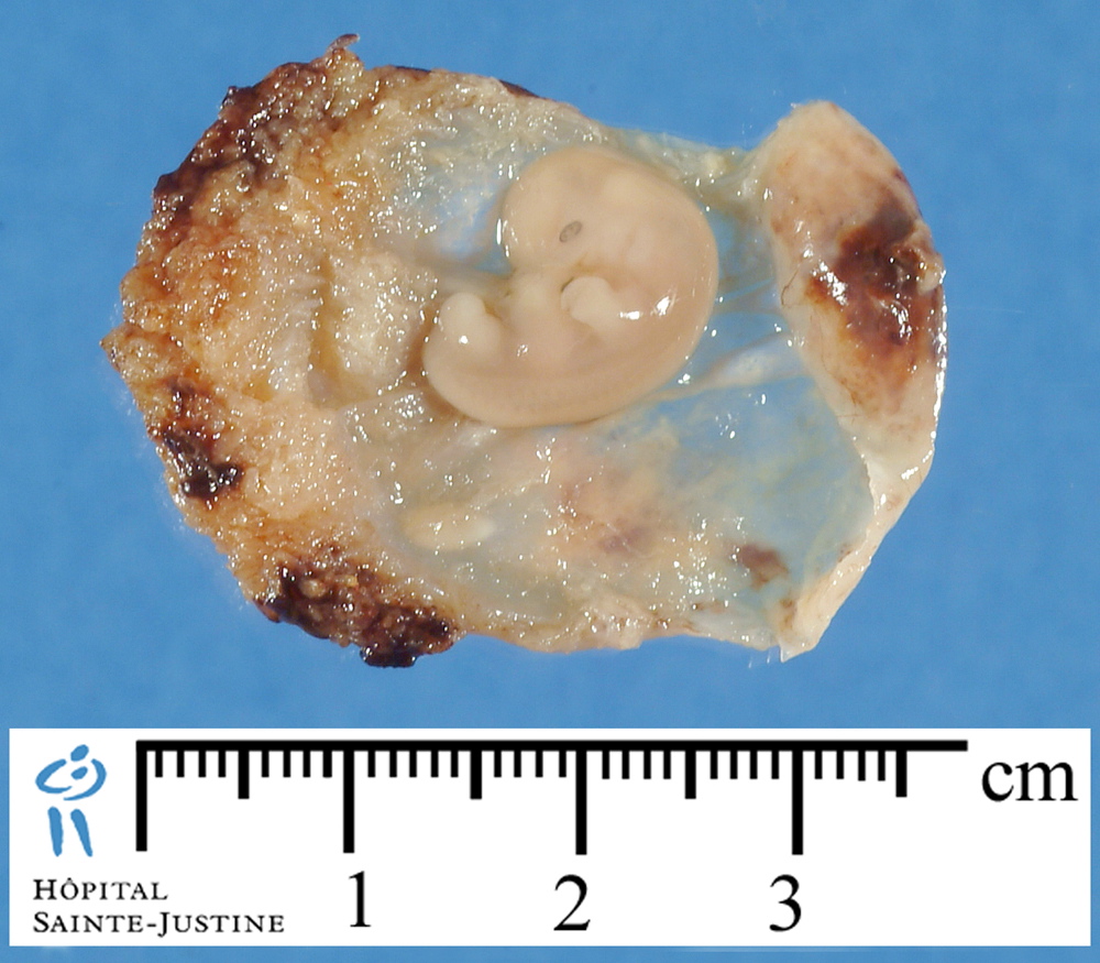 embryo_12mm_2.jpg