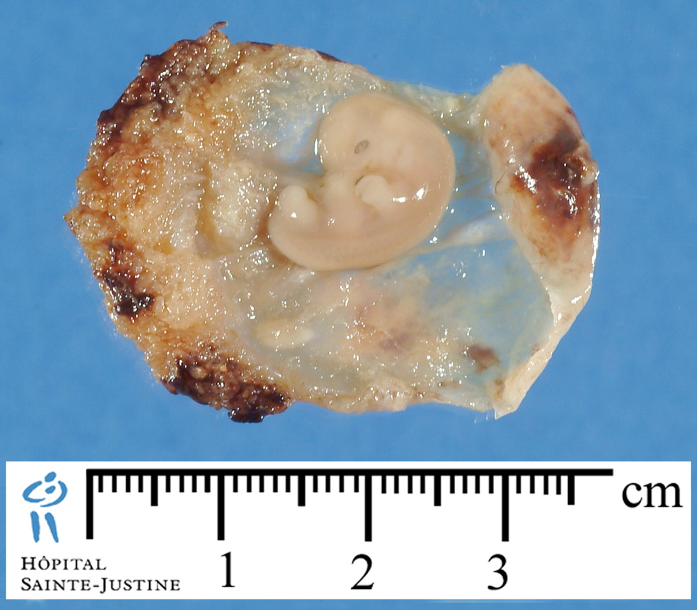 embryo_12mm_2.jpg