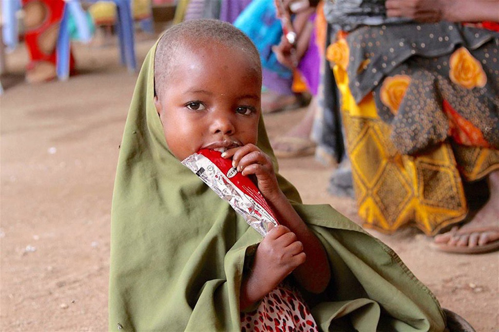 Somalia_malnutrition_UNICEF.jpg