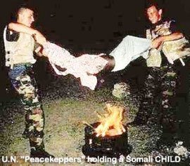 un-peace-keepers-burn-somali-child-over-