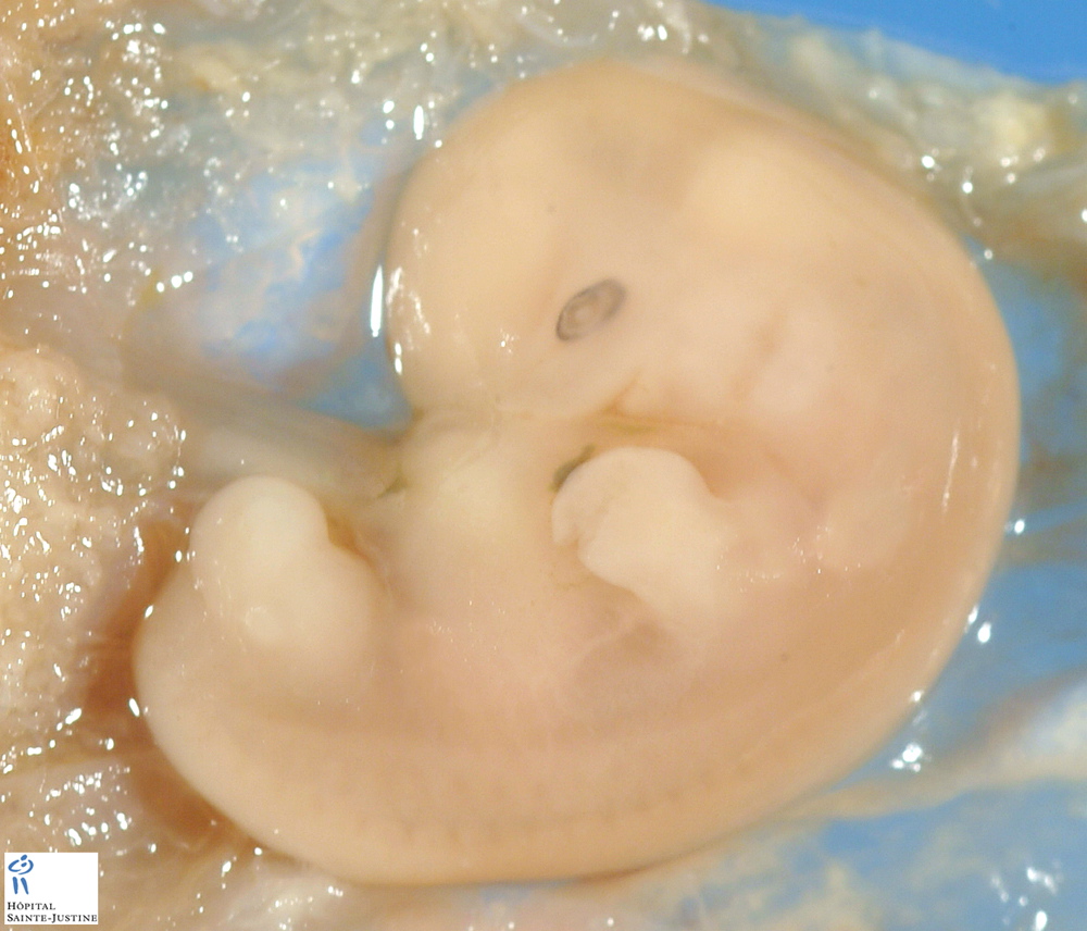 embryo_12mm_c.jpg
